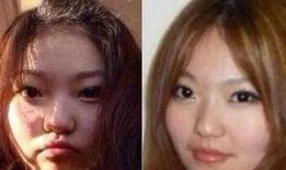 爆料小猪整容视频大全,整容前后对比视频大盘点