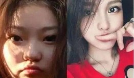 爆料小猪整容视频大全,整容前后对比视频大盘点